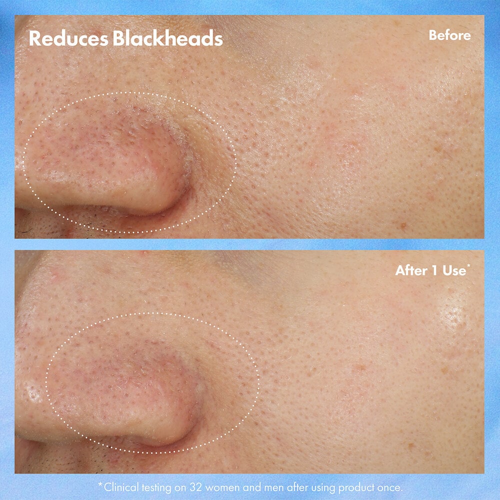 Clear Improvement™ Blackhead Clearing Mask-to-Scrub